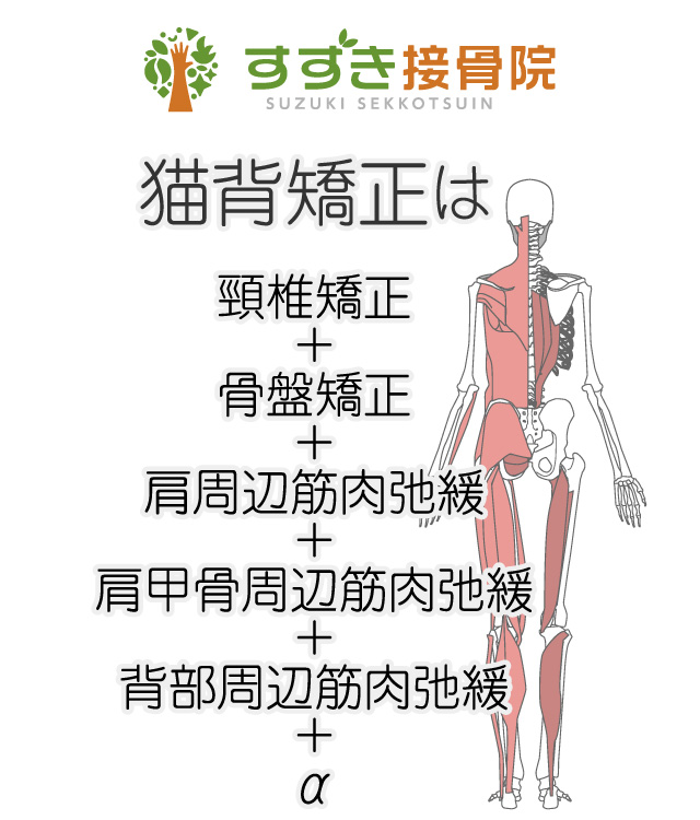 猫背矯正ページへ 猫背矯正イメージ